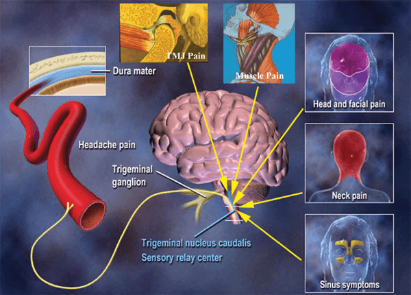 Image of Trigeminal nucleus caudalis Sensory relay center